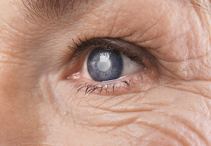 VisualEyes Optometrists - Eye Care
