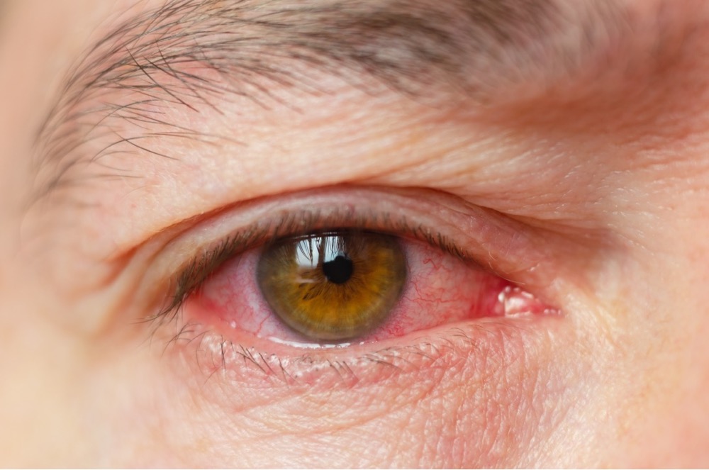 VisualEyes Optometrists - Pink eye