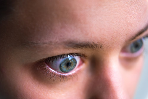 VisualEyes Optometrists - Bulging Eyes